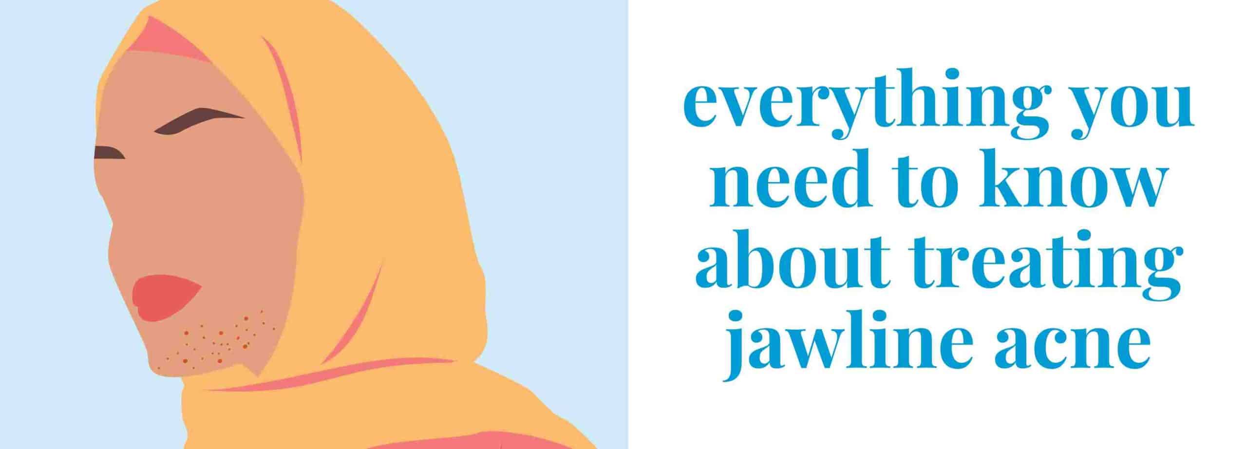 Jawline Acne: Causes, Prevention & Tips For Quick Relief