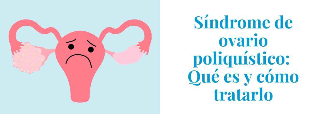 Síndrome De Ovario Poliquísticoqué Es Efectos Y Tratamiento 9049